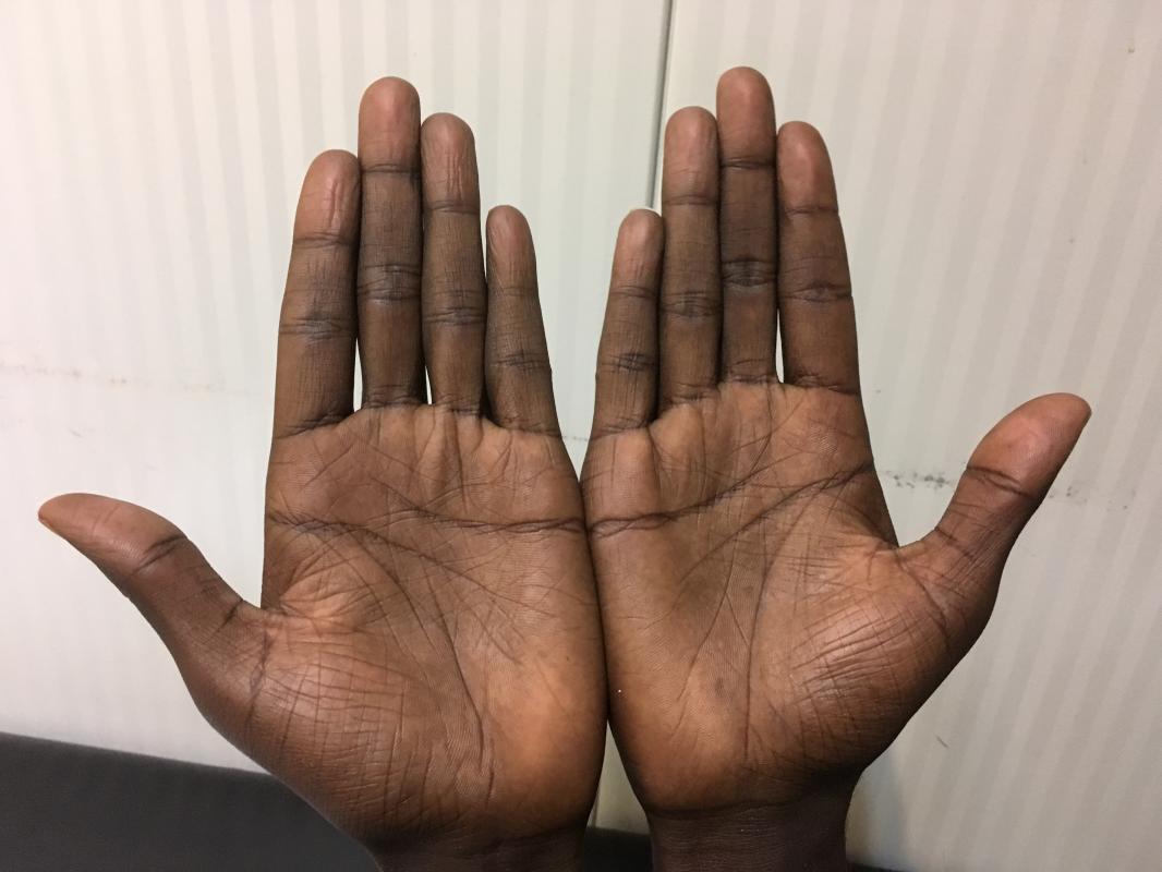 Bij Grensdokter 12.jpg