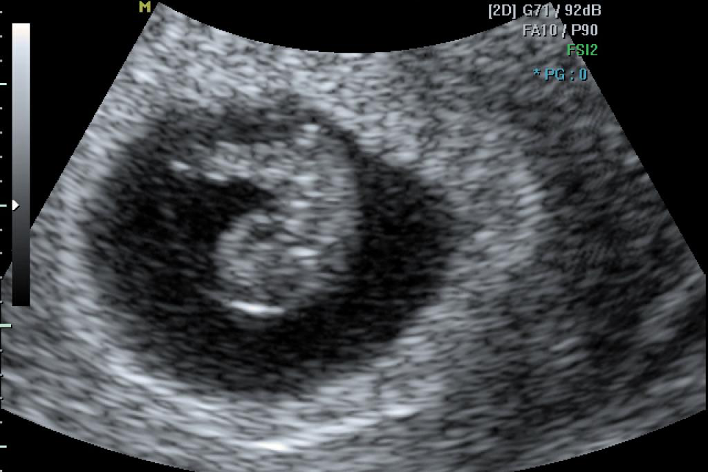 Bij Grensdokter 13.png